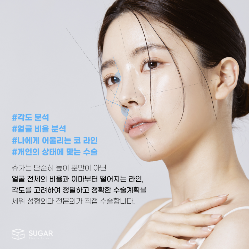 코성형 보형물 어떤게 있을까? 관련 이미지 5