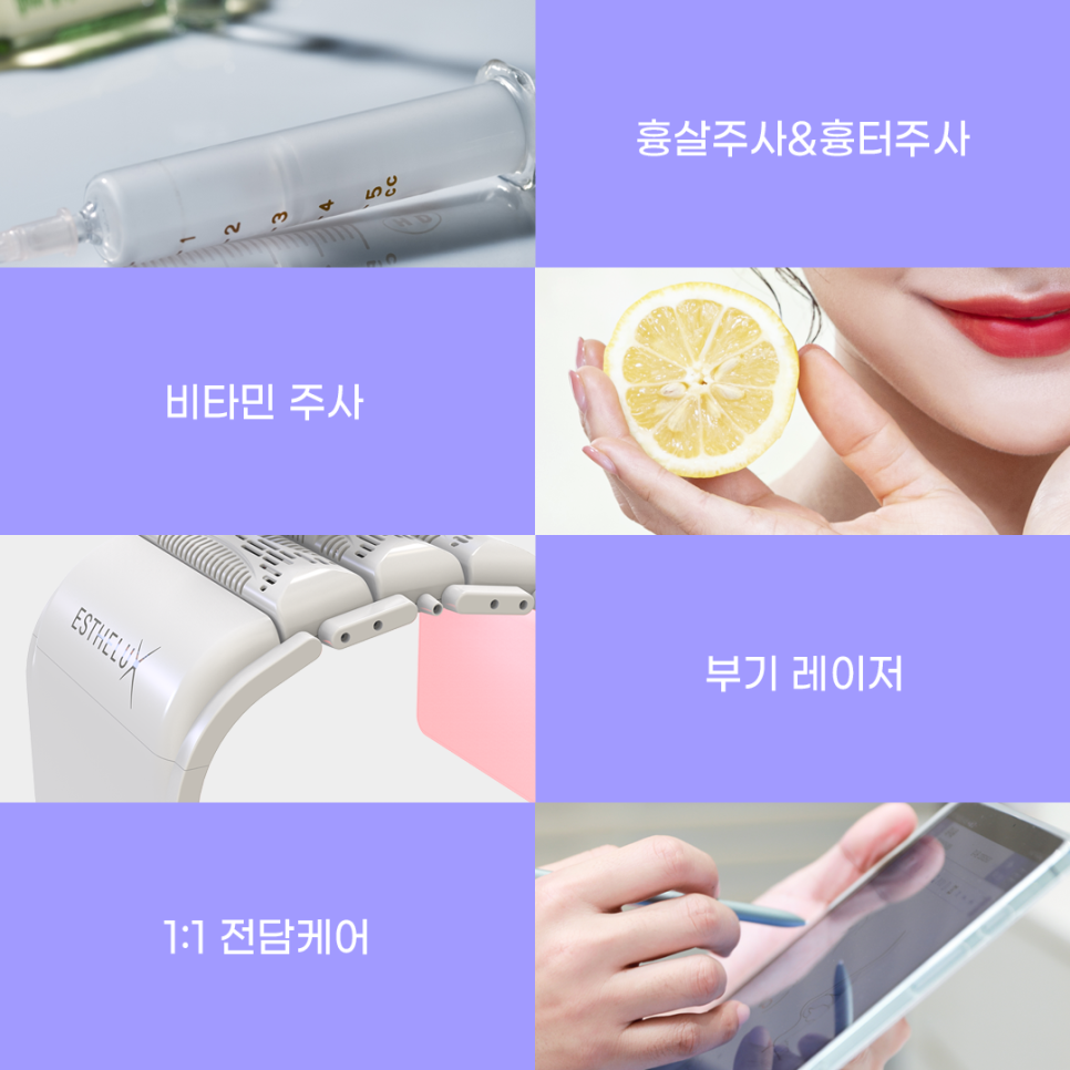짝눈 교정 종류부터 해결까지 관련 이미지 18