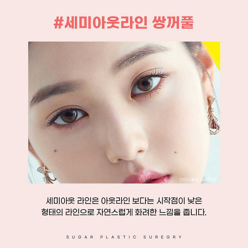 연예인쌍수라인으로 보는 쌍꺼풀라인 관련 이미지 5