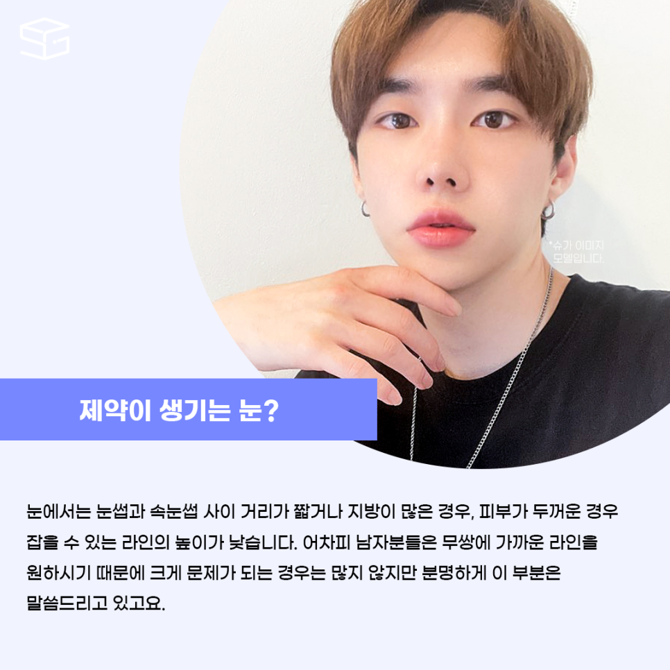 남자성형 대박나는 조건 관련 이미지 4