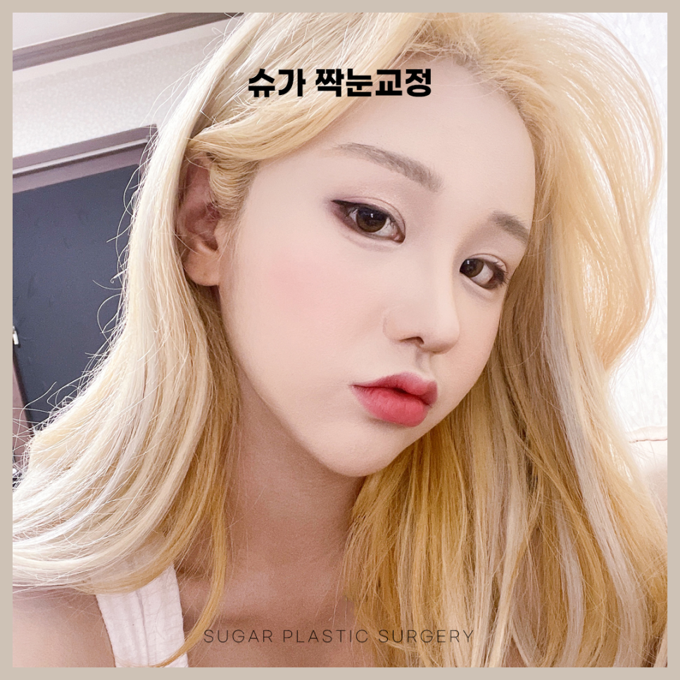 짝눈교정 어떻게 알아볼까 관련 이미지 4