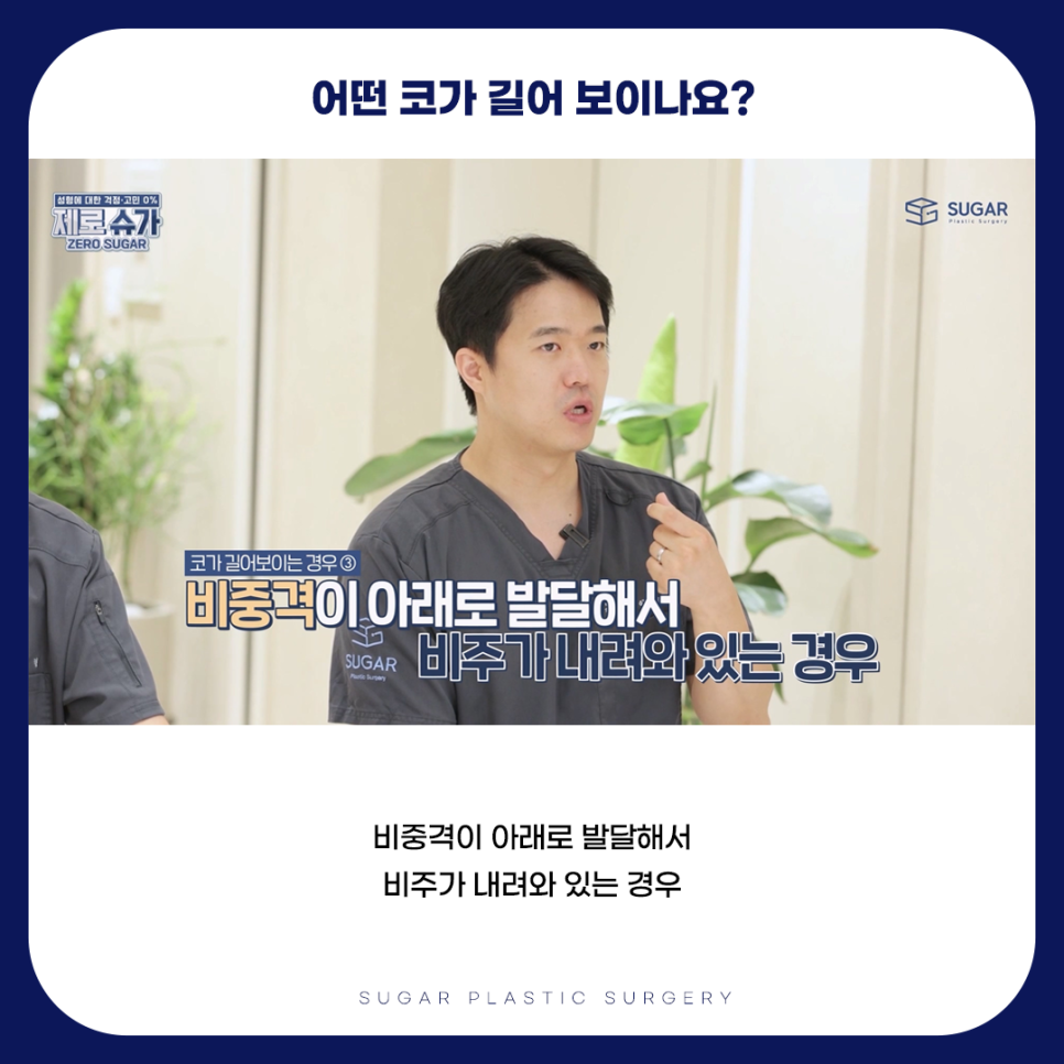 긴코 VS 짧은코 관련 이미지 5