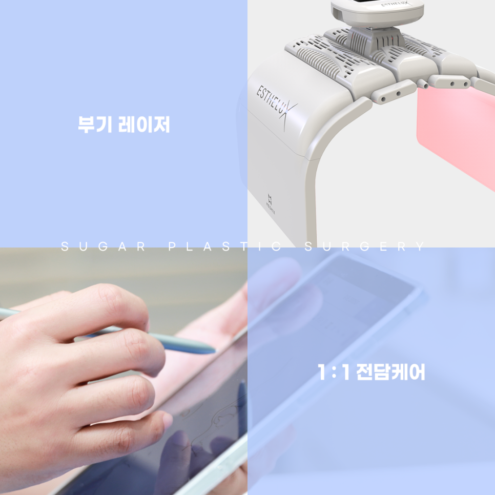 들창코 그 원인과 해결방법 관련 이미지 11