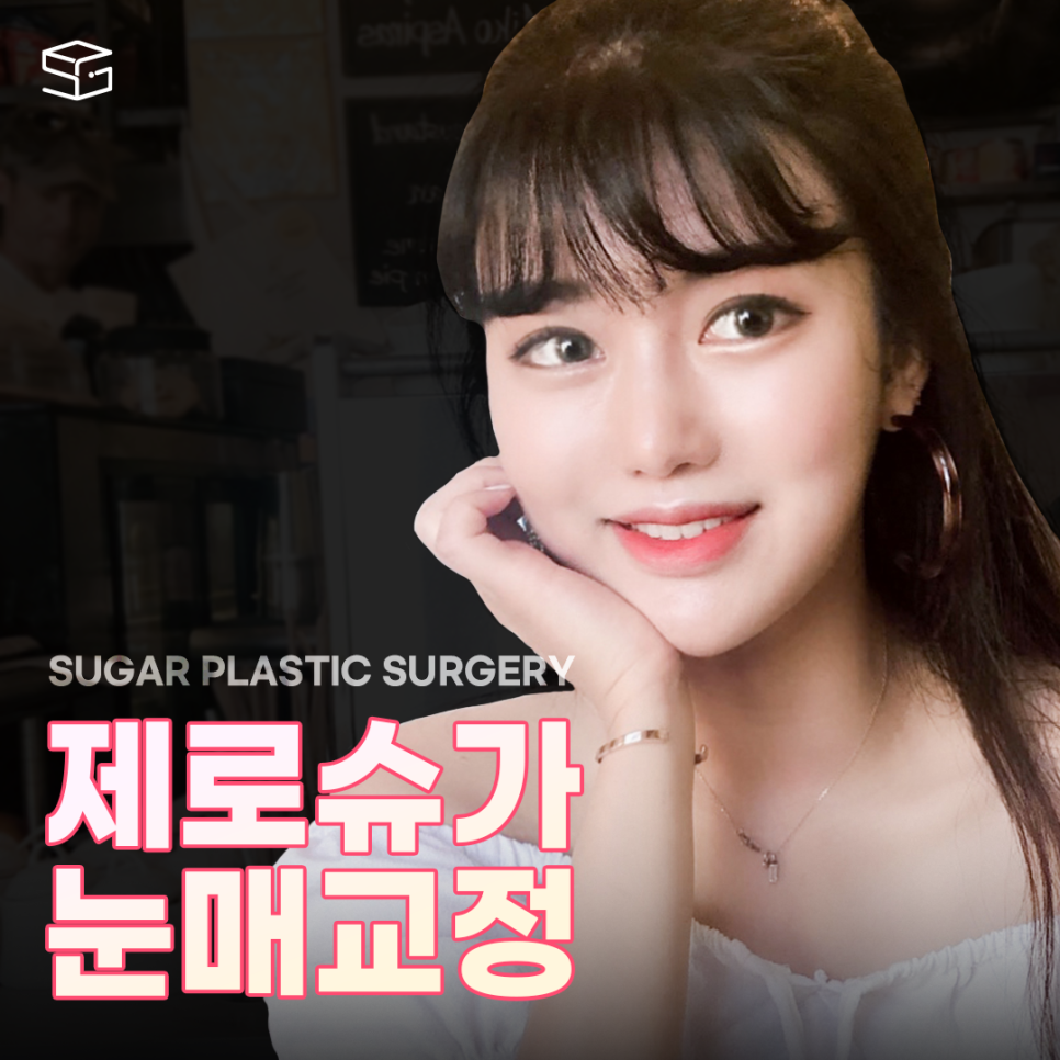 눈매교정 꼭 해야할까? 관련 이미지 1