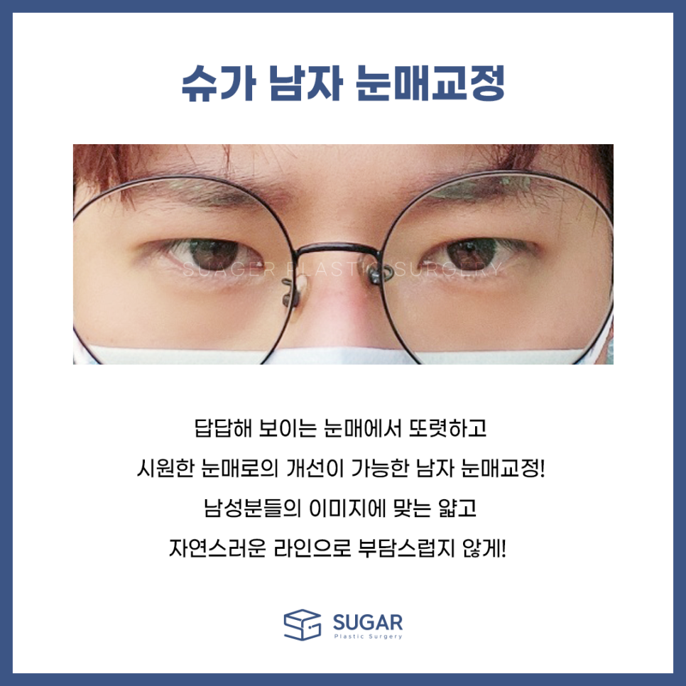 남자눈성형 뭐가 다를까? 관련 이미지 2