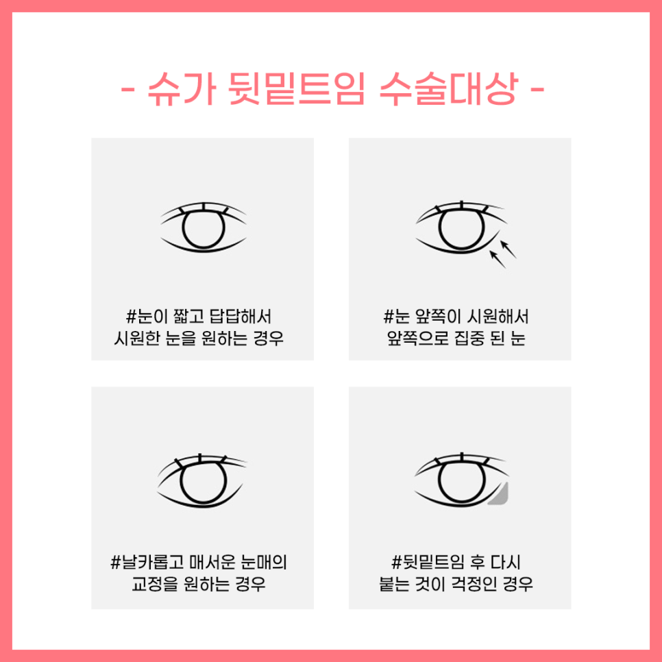 뒷밑트임 붙을까봐 걱정이라면? 관련 이미지 3