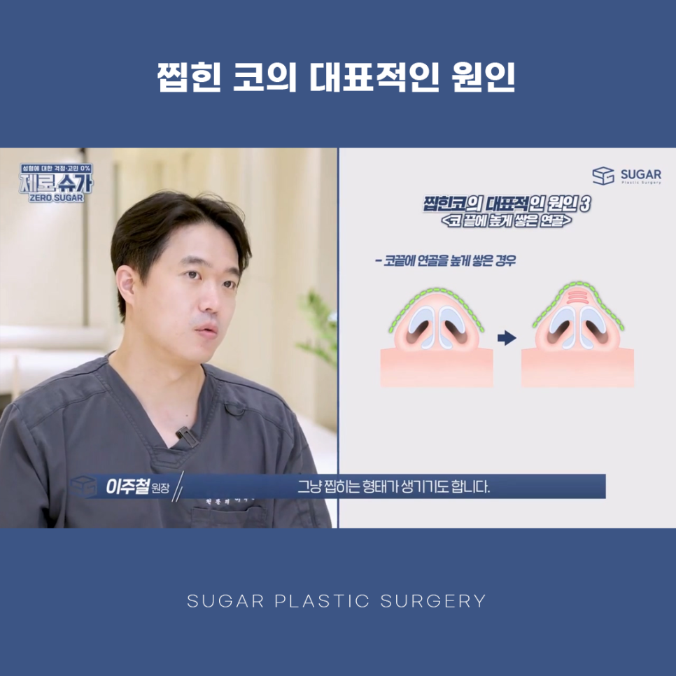 찝힌코 왜 생기는 걸까? 관련 이미지 6