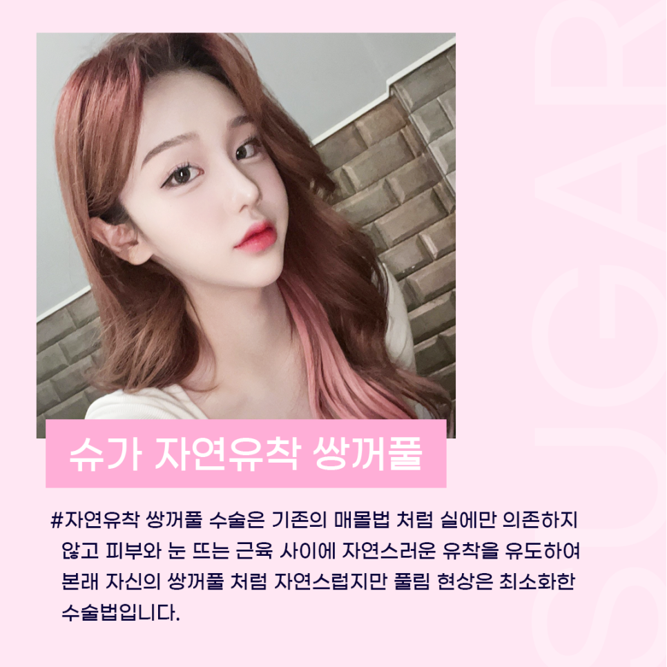 자연유착 이름부터 특징까지 총정리 관련 이미지 3
