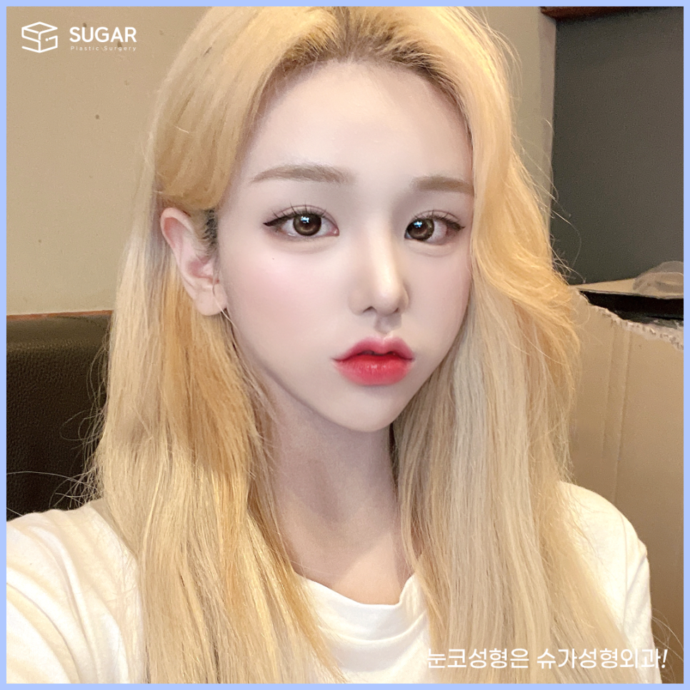 들창코 그 원인과 해결방법 관련 이미지 6