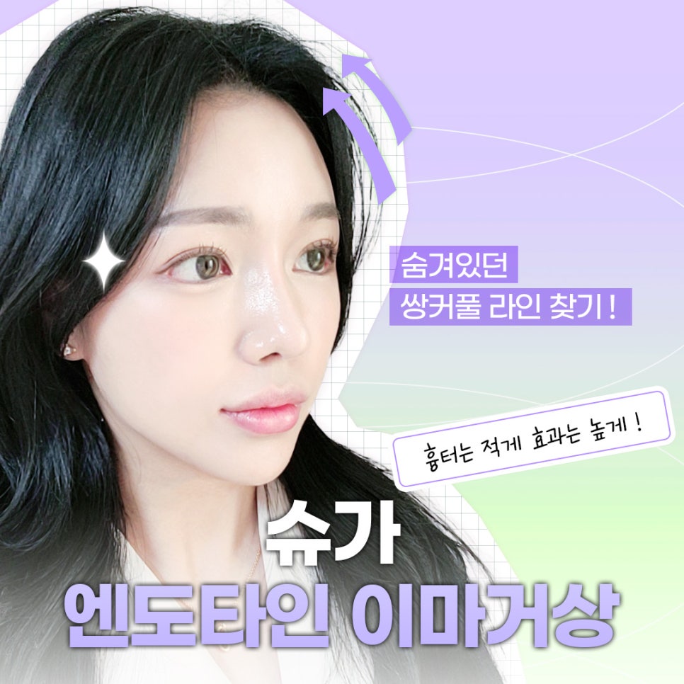 강남역이마거상수술 엔도타인으로 고정점을 확실히 관련 이미지 1