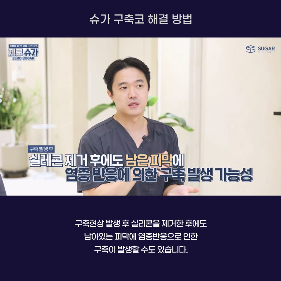 코재수술의 끝판왕, 구축코 케이스와 해결방법 관련 이미지 4