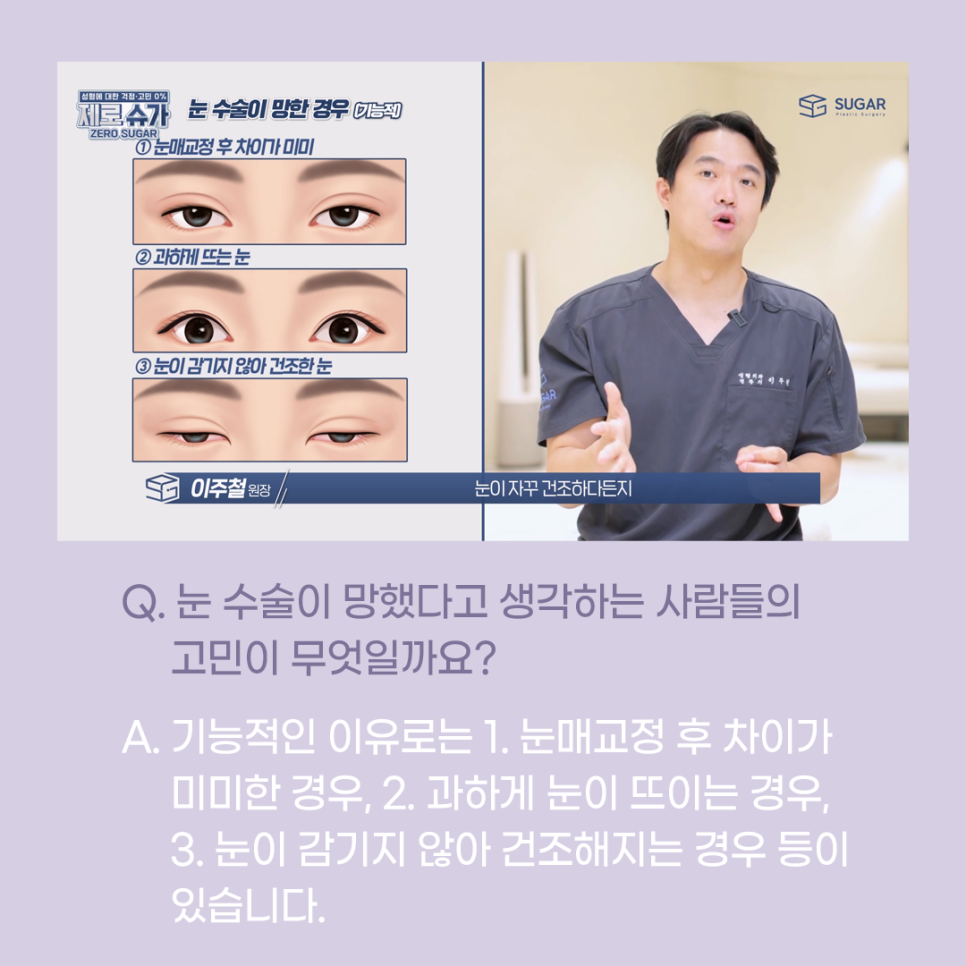 [슈가성형외과] 눈성형 실패하는 이유! 관련 이미지 4