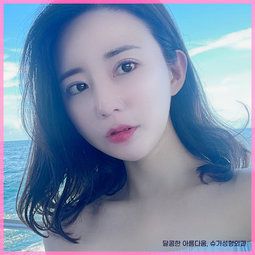 자연유착 이름부터 특징까지 총정리 관련 이미지 10