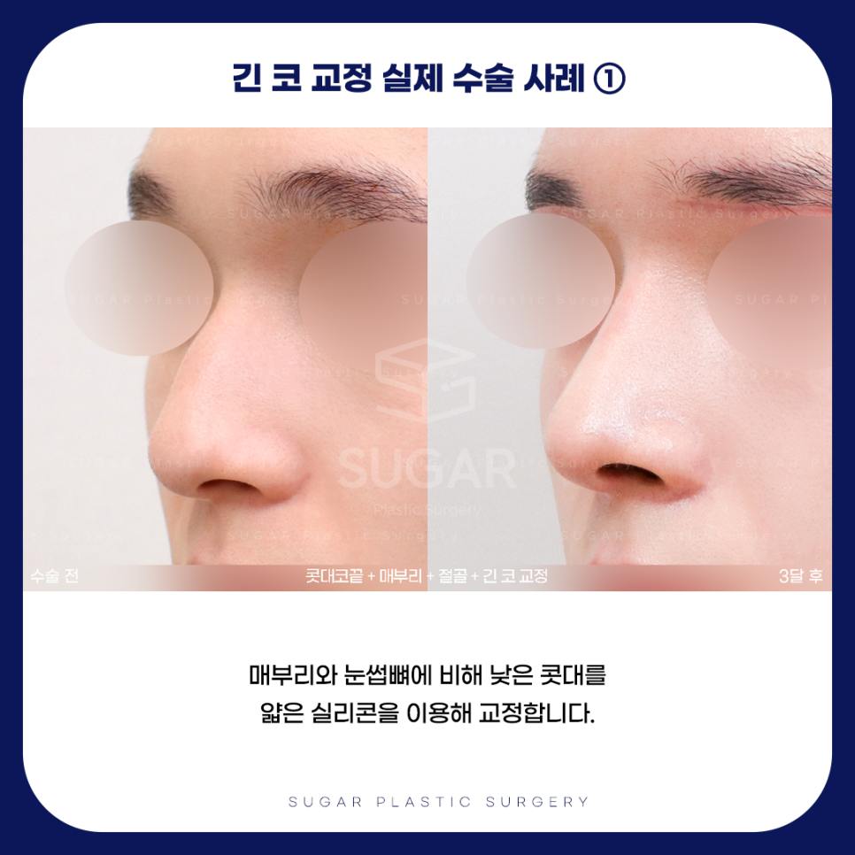 긴코 VS 짧은코 관련 이미지 7
