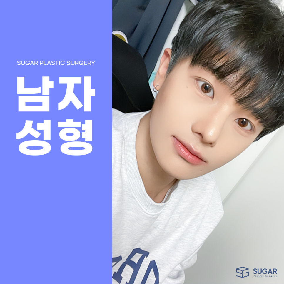 남자성형 대박나는 조건 관련 이미지 1