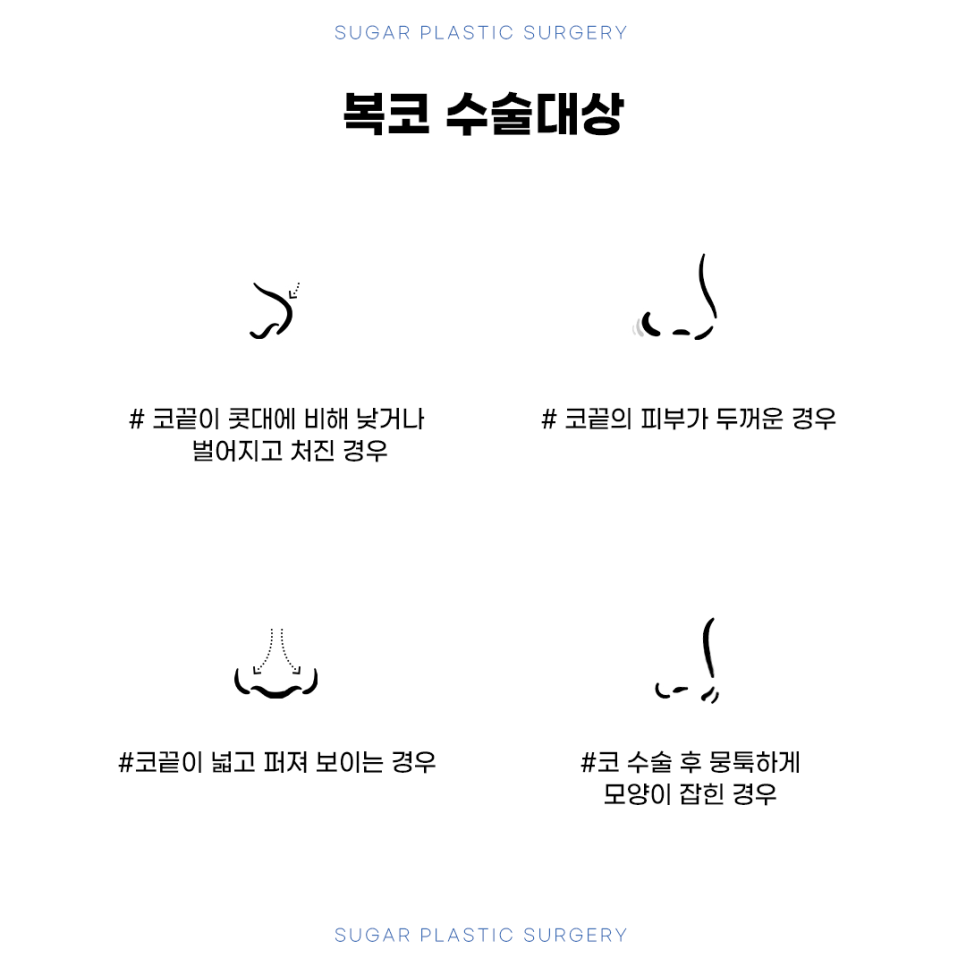 복코성형 원인에 따른 수술방법 관련 이미지 5