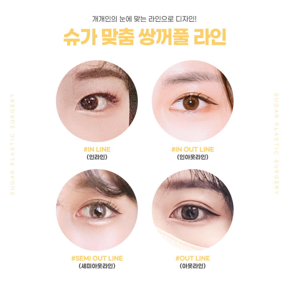 자연유착과 절개의 차이점 관련 이미지 5