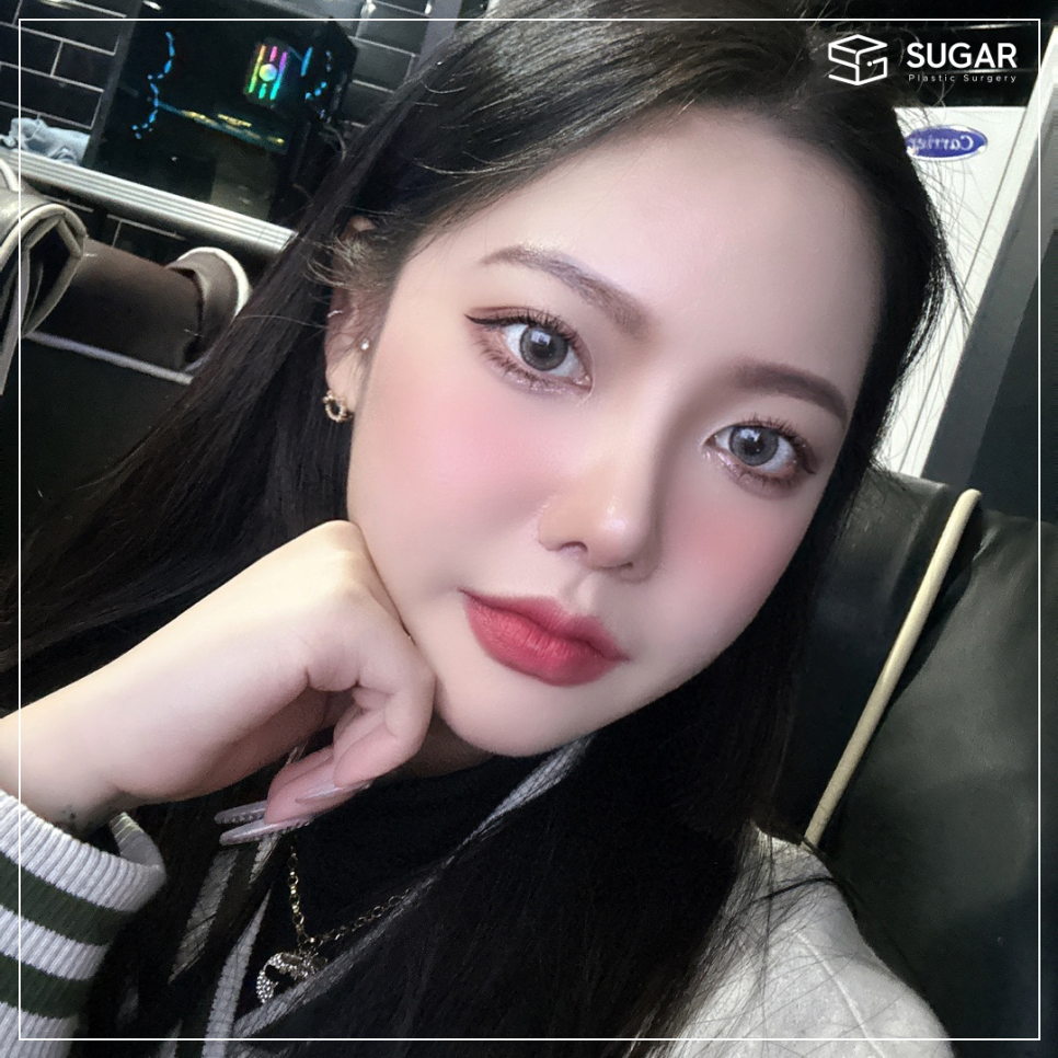 코재수술 그 유형과 해결방법은? 관련 이미지 13