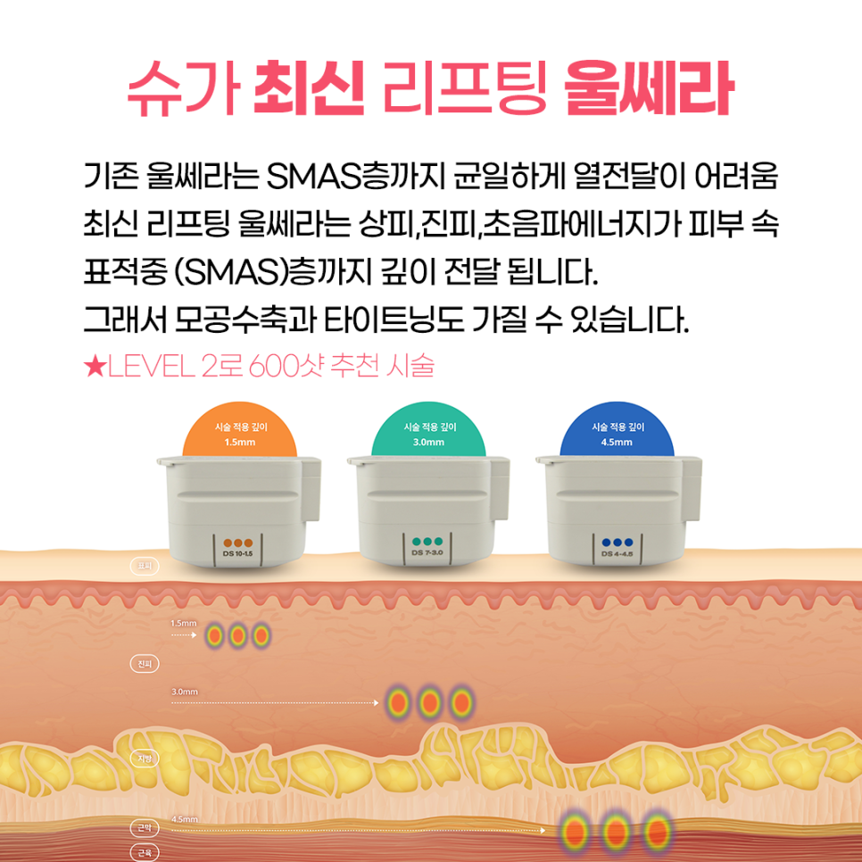 2024년 최신 울쎄라리프팅잘하는곳 관련 이미지 3