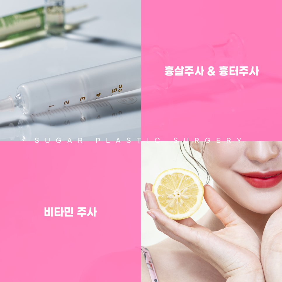 자연유착 이름부터 특징까지 총정리 관련 이미지 6