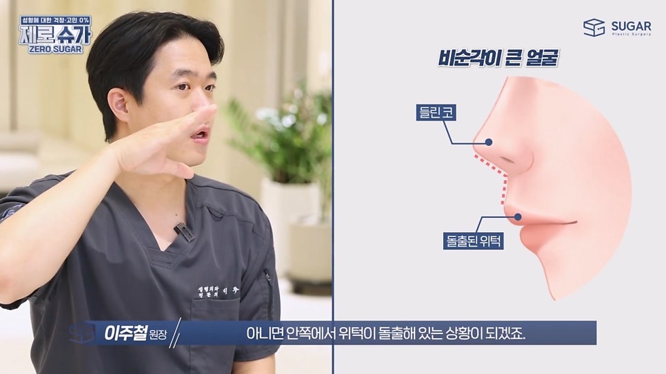 비주와 비순각교정 어떻게 할까? 관련 이미지 4
