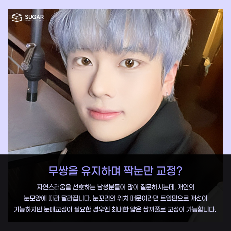 짝눈 교정 종류부터 해결까지 관련 이미지 10
