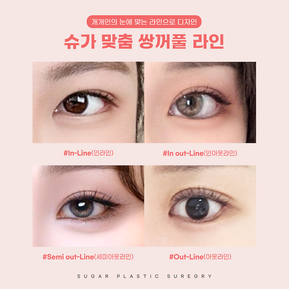 연예인쌍수라인으로 보는 쌍꺼풀라인 관련 이미지 2