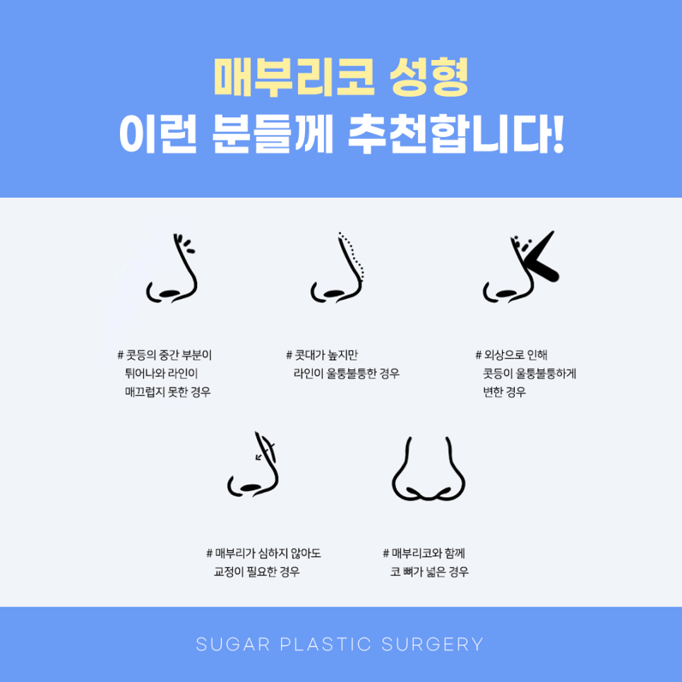 매부리코수술 매끄러운 라인으로 관련 이미지 6