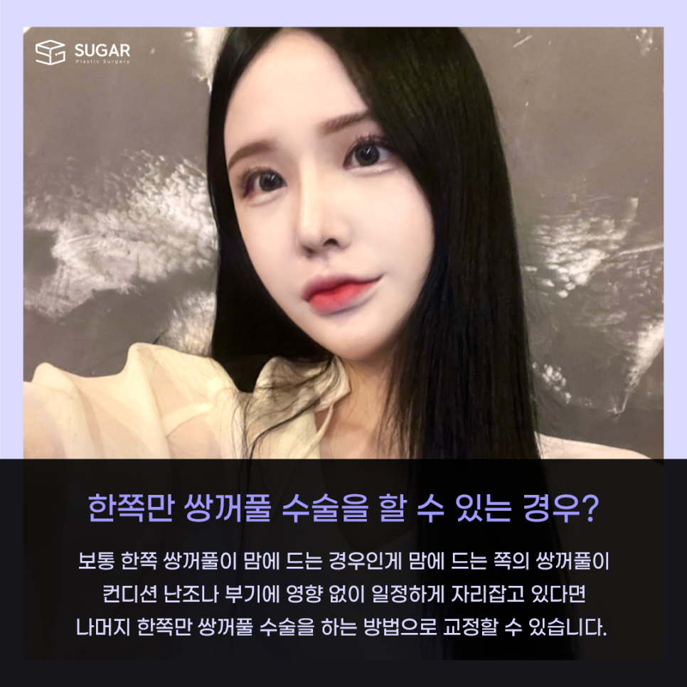 짝눈 교정 종류부터 해결까지 관련 이미지 6