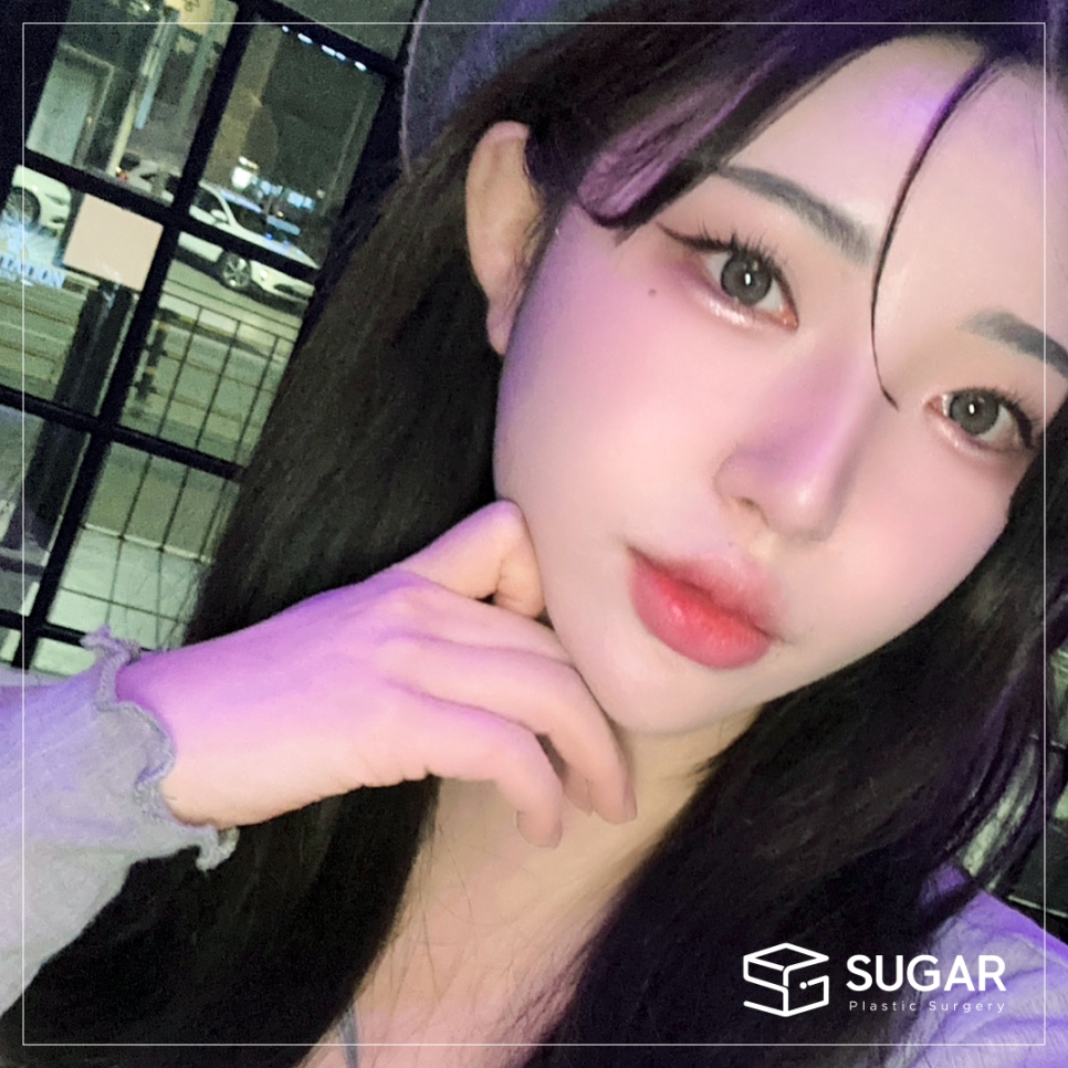 비주와 비순각교정 어떻게 할까? 관련 이미지 11