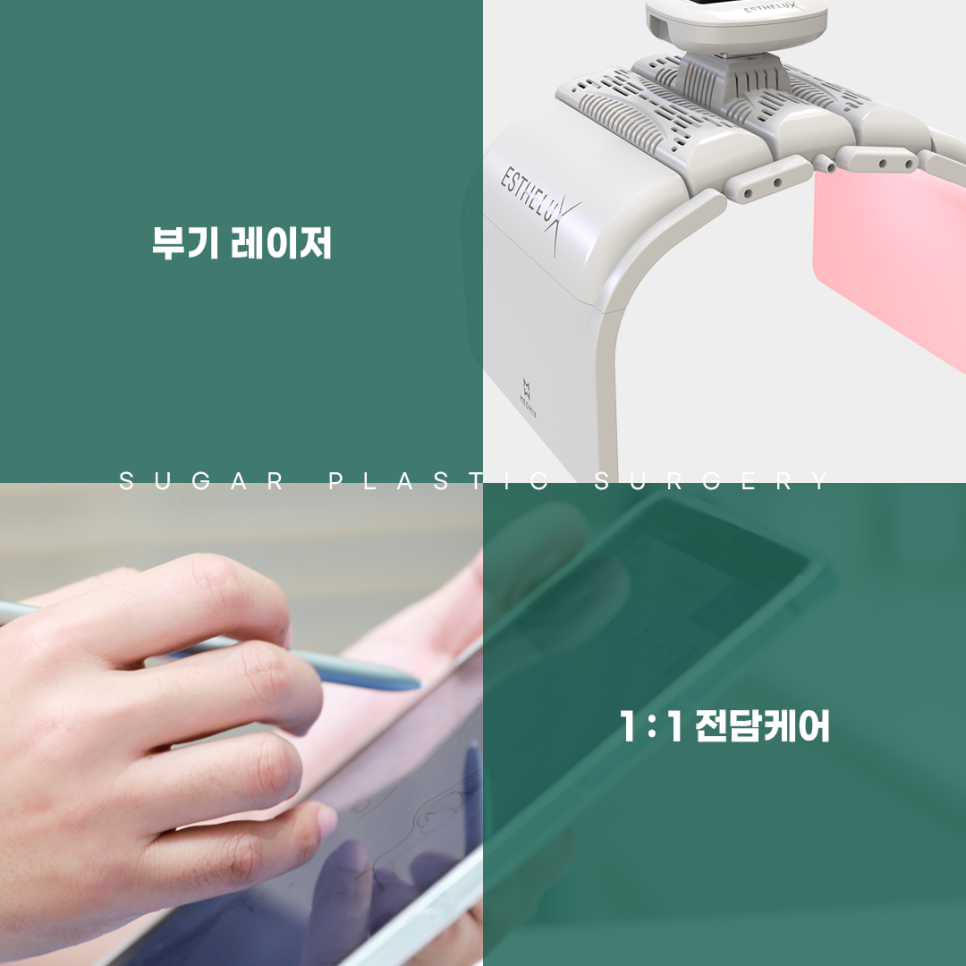 코성형부작용 어디까지 알아봤나요? 관련 이미지 11