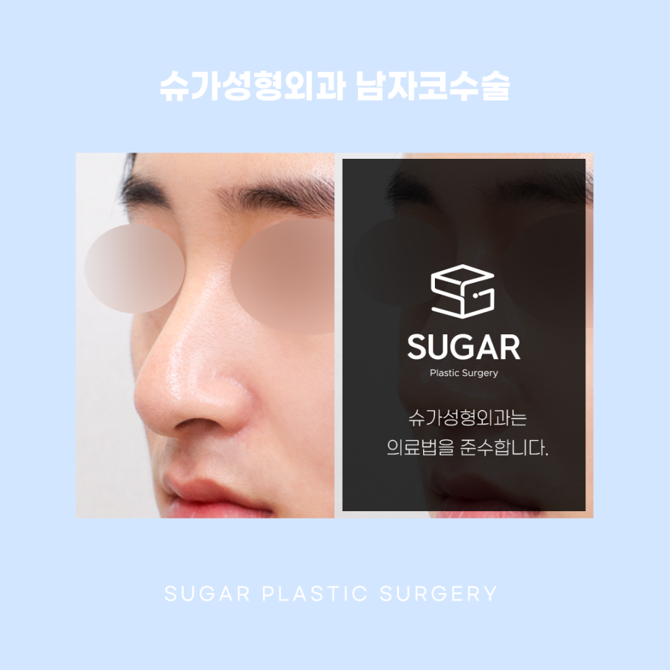남자코수술 여자랑 어떻게 다를까 관련 이미지 6