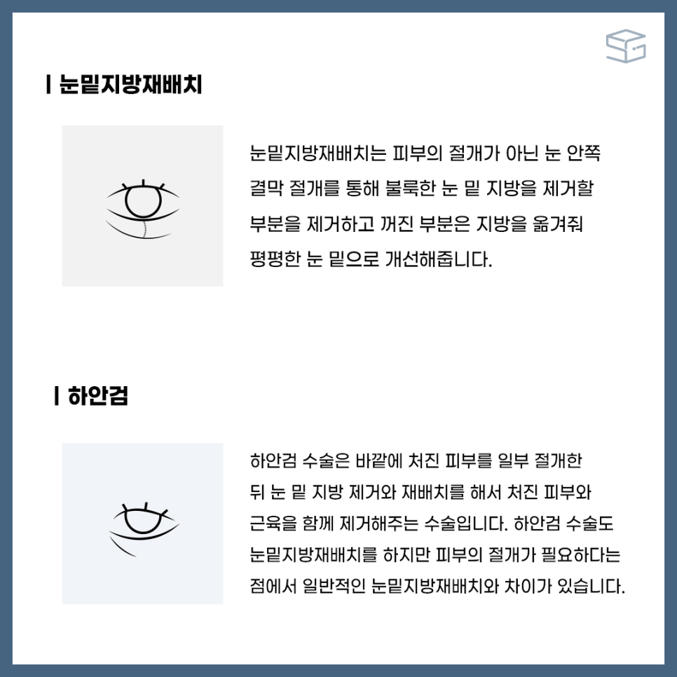 눈밑지방재배치 그 방법과 효과 관련 이미지 2