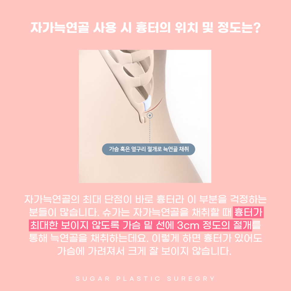 기증늑 자가늑 어떤게 좋을까? 관련 이미지 7