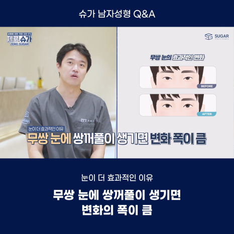 남자성형에 관한 궁금한 점 다 알려드립니다! 관련 이미지 3