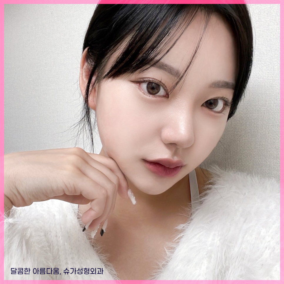 자연유착 이름부터 특징까지 총정리 관련 이미지 9