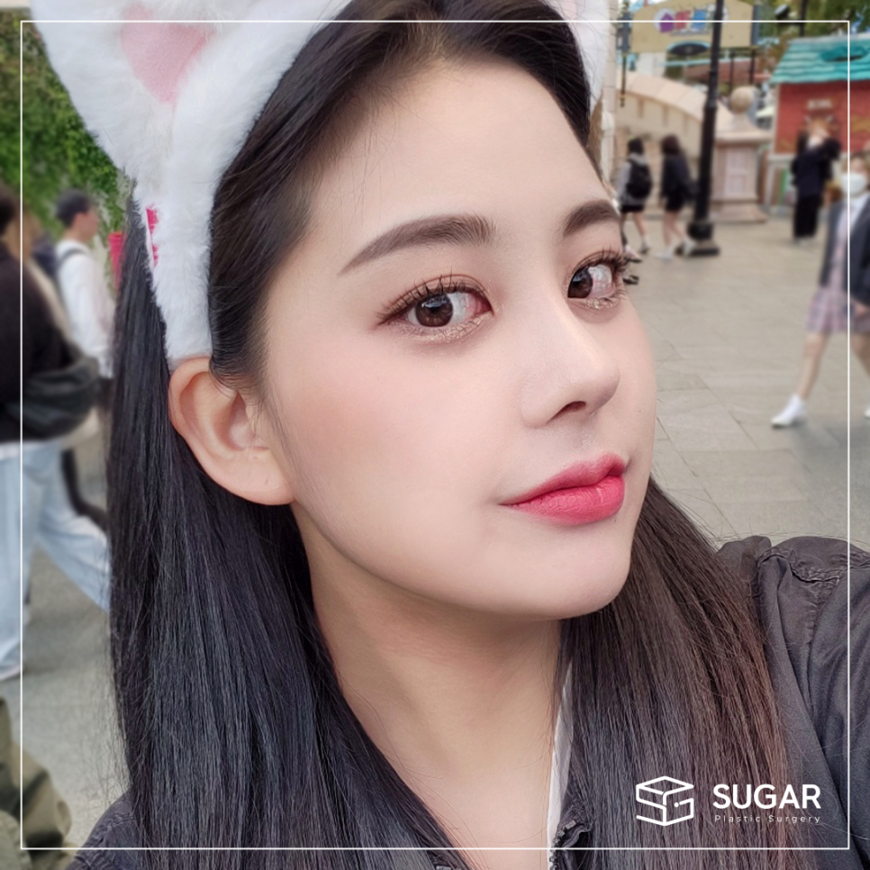 기증늑 자가늑 어떤게 좋을까? 관련 이미지 6