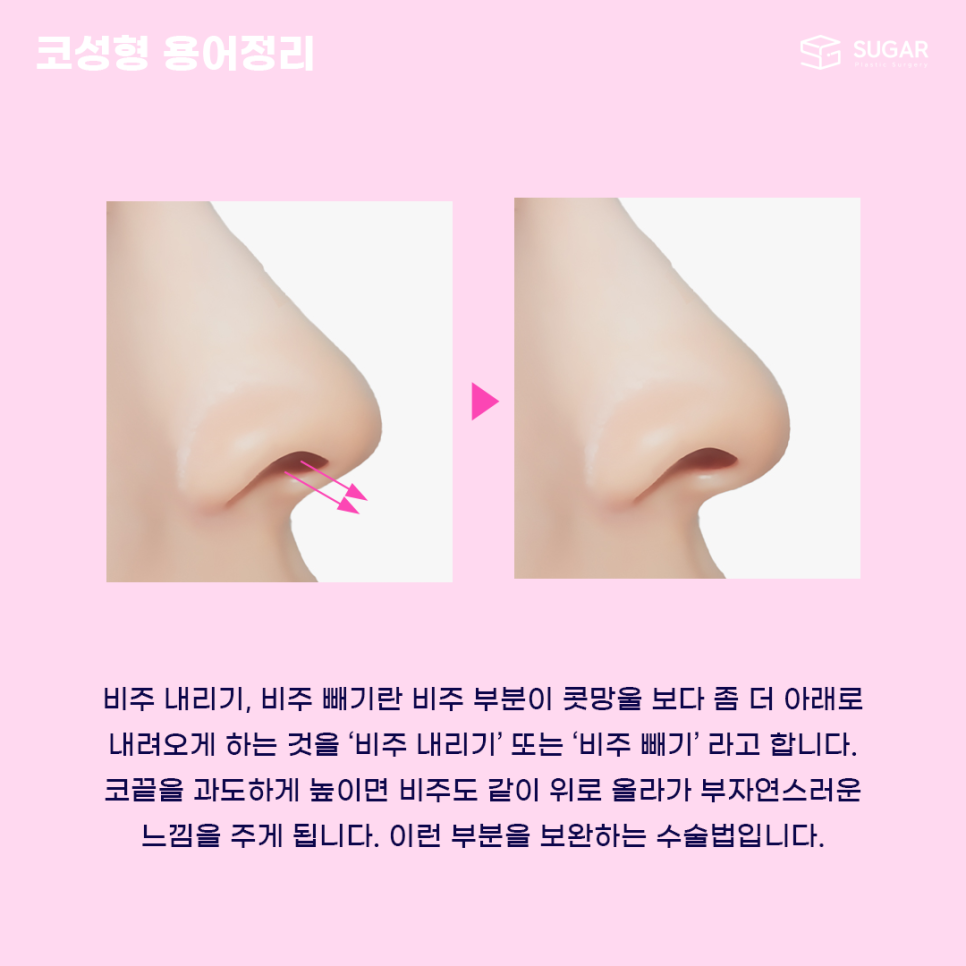 코성형 처음이라면? 용어정리! 관련 이미지 9