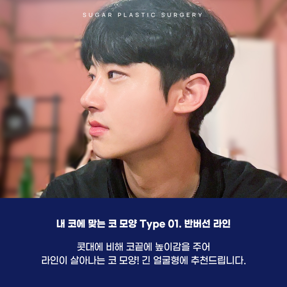 남자코수술 여자랑 어떻게 다를까 관련 이미지 3
