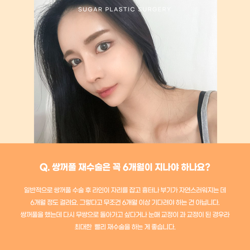 눈재수술 최대 몇 번까지 가능할까? 관련 이미지 8