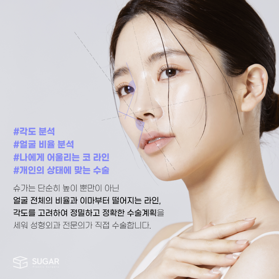 코성형, 어떻게 알아보는게 좋을까? 관련 이미지 3