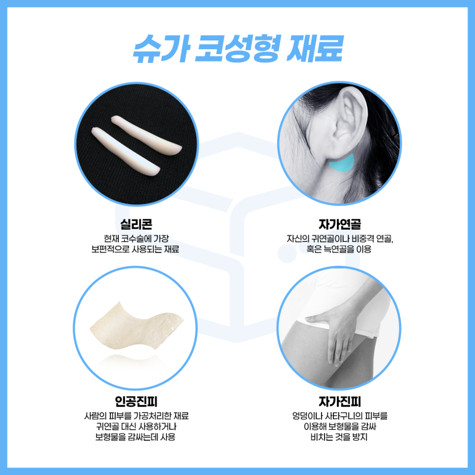 코성형 보형물 어떤게 있을까? 관련 이미지 3