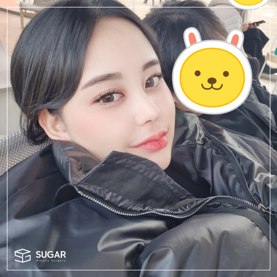 비절개눈매교정 VS 절개눈매교정 관련 이미지 5