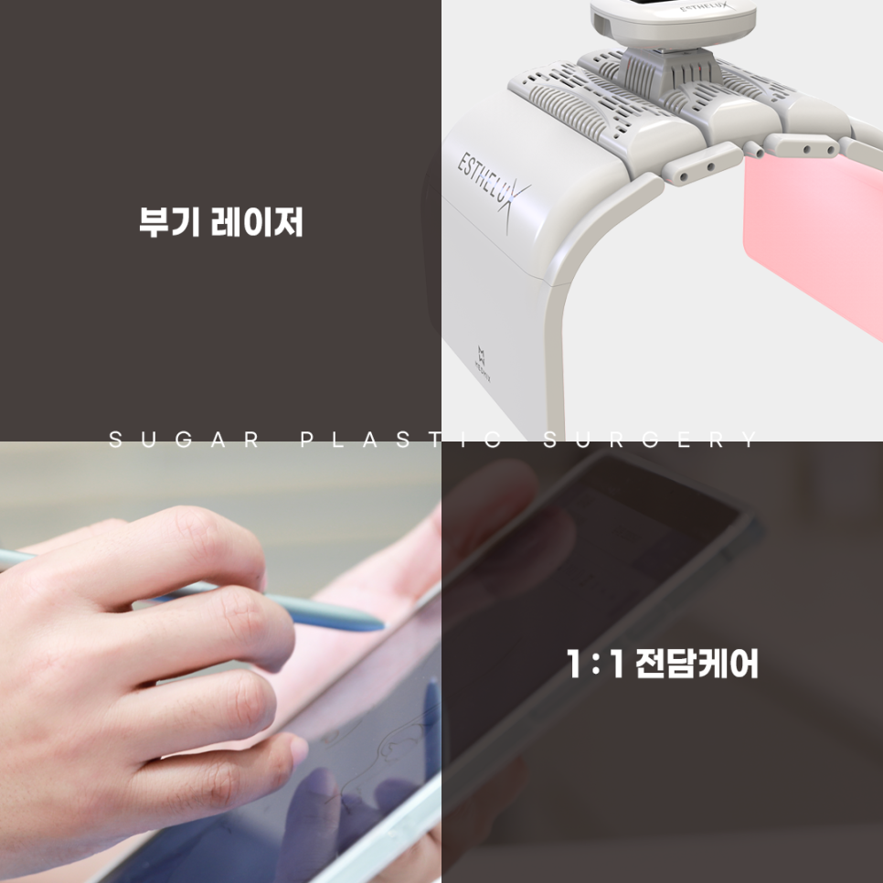 라인높이기 눈재수술 이것만은 알고가자 관련 이미지 15