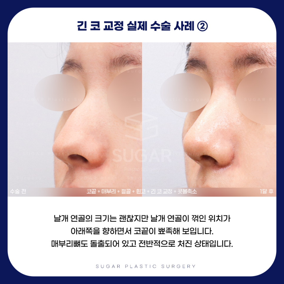 긴코 VS 짧은코 관련 이미지 10