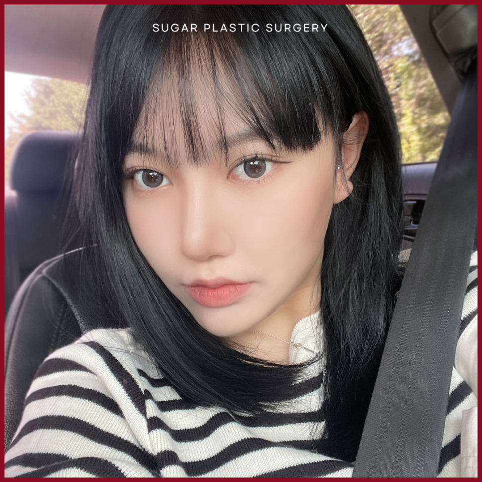 휜코 성형 알아보고 있다면 관련 이미지 6