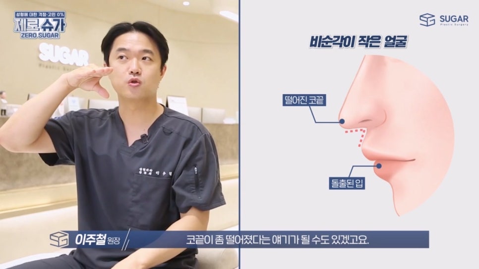 비주와 비순각교정 어떻게 할까? 관련 이미지 5