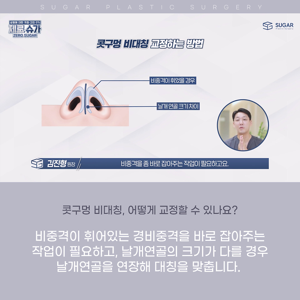 코 성형 후 콧구멍 짝짝이가 되었다?! 관련 이미지 7