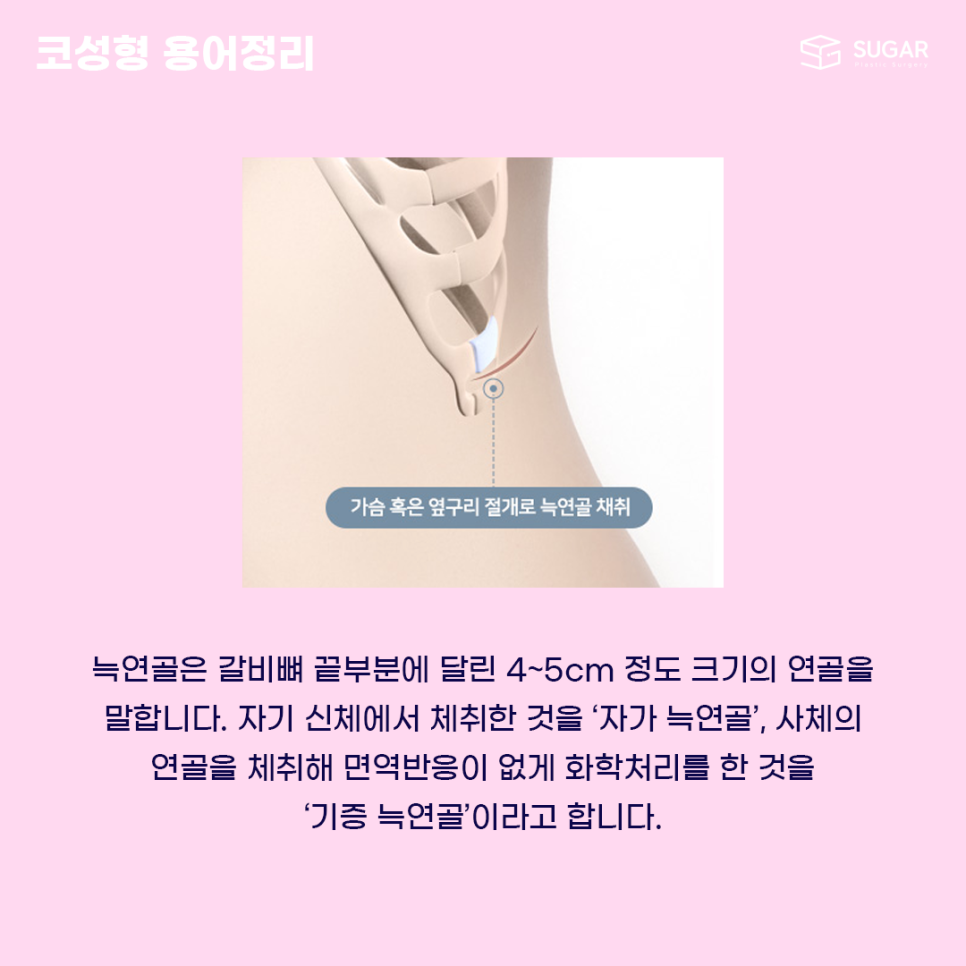 코성형 처음이라면? 용어정리! 관련 이미지 3