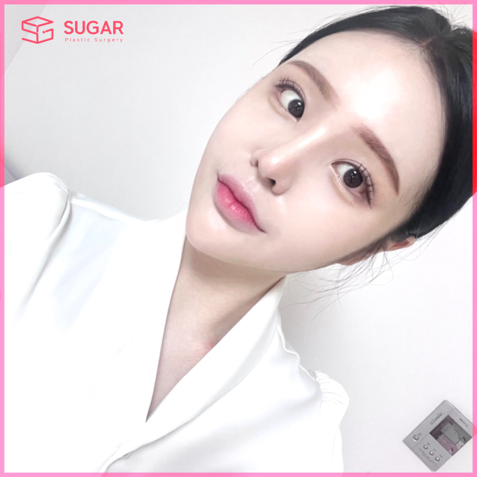 코성형 대박나는 코 관련 이미지 13
